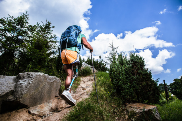 Person with a prosthetic leg hiking uphill on a sunny day with a backpack and trekking poles surrounded by greenery and rocks.